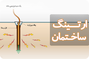 Read more about the article سیستم ارتینگ چیست و چه کاربردی دارد؟